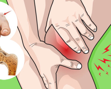 6 Common Symptoms of Osteoarthritis